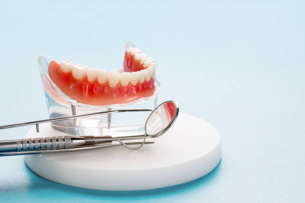Full Mouth Reconstruction in Glenwood, IL